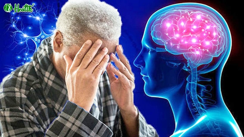 Bệnh Alzheimer: Tìm Hiểu Sâu Hơn Về Nguyên Nhân, Triệu Chứng Và Phương Án Điều Trị